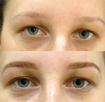 Vopsirea sprâncenelor cu henna Henna SPA, exemplu de lucrare ProLaser Moldova