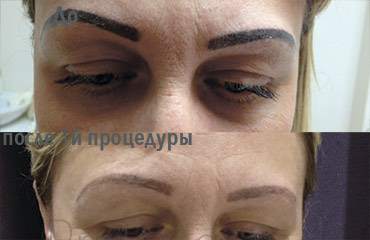 Lucrare ProLaser Moldova