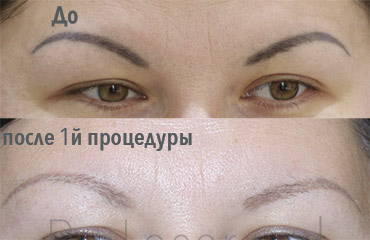 Lucrare ProLaser Moldova