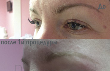 Lucrare ProLaser Moldova
